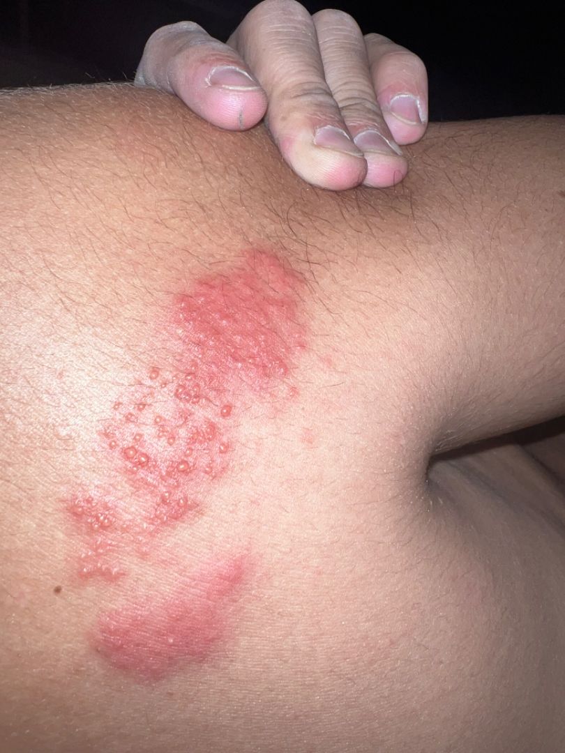 Clinical angled view